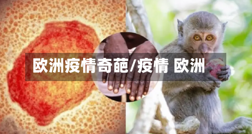 欧洲疫情奇葩/疫情 欧洲-第2张图片