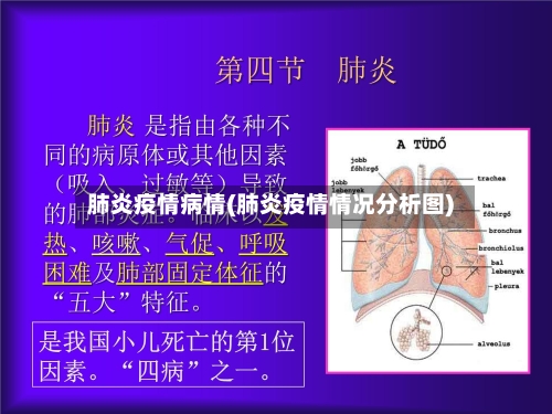 肺炎疫情病情(肺炎疫情情况分析图)-第1张图片